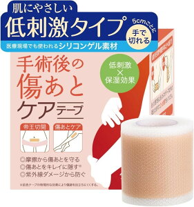 e畆ȈďCՃPAe[v 鉤؊J h x \Snɂ VRe[v e[v یe[v B PCh (4x150cmiŐ؂^Cv 2j)