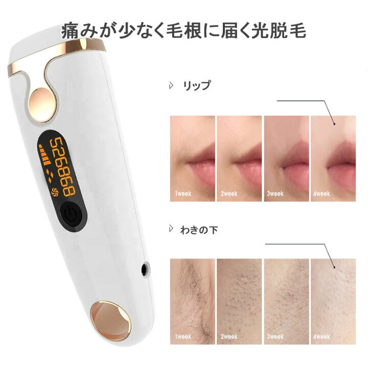 楽天市場】脱毛器 女性 ムダ毛 除毛 99万回以上 IPL フラッシュ 男性 