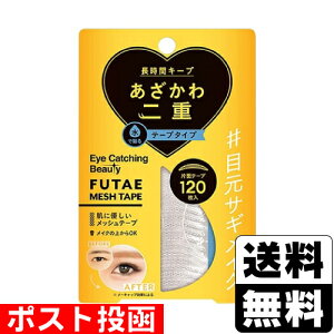 |XgACLb`Or[eB ӂbVe[v 120