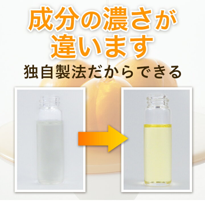 楽天市場】アンミオイル(30ml) 2本セット【送料無料】 : あんず美容 