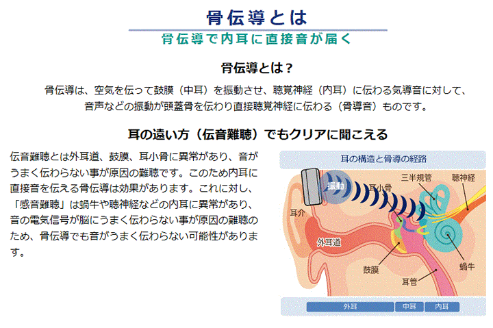 楽天市場】【平日15時まで即日出荷】集音器付 骨伝導ワイヤレス