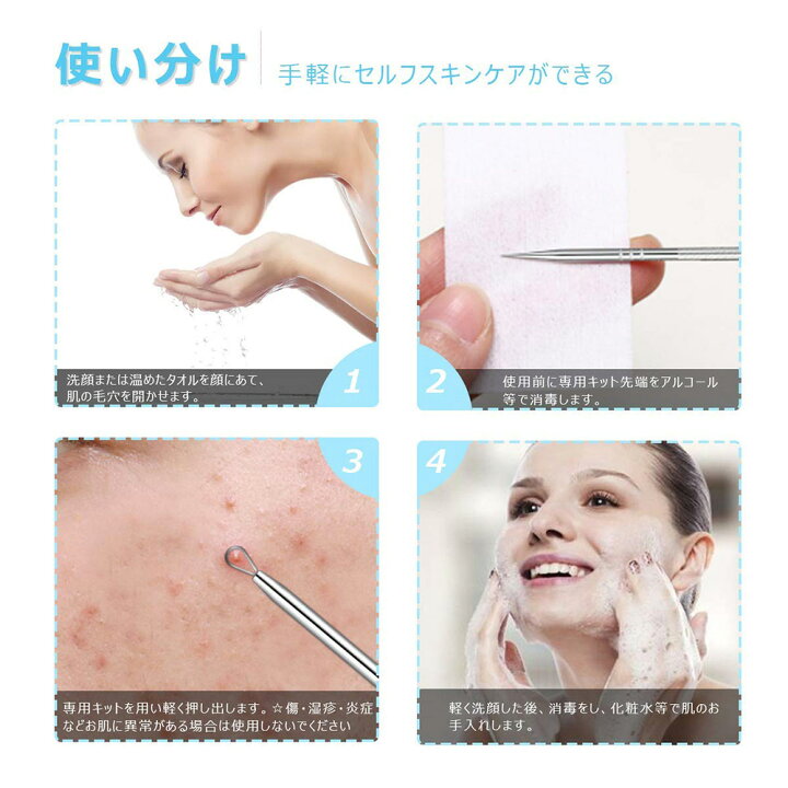 楽天市場 2点セット 毛穴ケア専用キット プロ仕様 高精度 抗菌ステンレス 日本語説明書付き いちご鼻すっきり 毛穴 黒ずみ 除去 角栓取り 鼻 角栓 ピンセット 角栓 スティック ニキビ取り コメドプッシャー 送料無料 メール便 Znewmark ジニューマーク